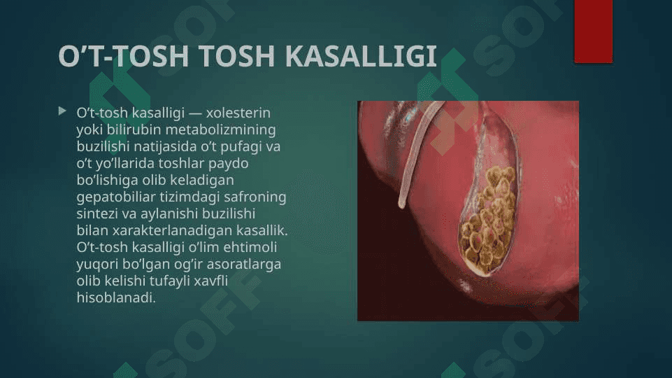 Oʻt qopi toshlari biokimyosi 3