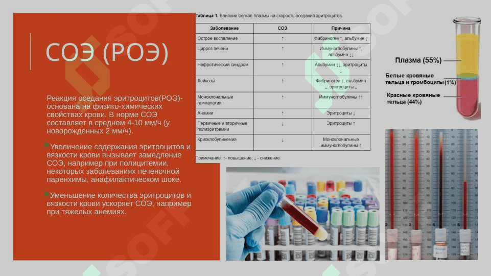 физико-химические изменения cвойств крови 7