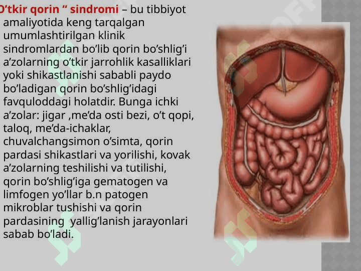 O'tkir qorin sindromi 2