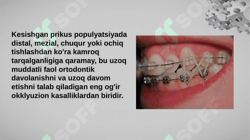 Kesishgan prikus 5