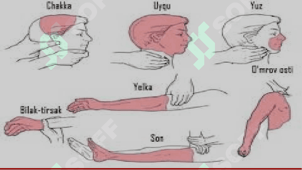 Favqulodda vaziyatlarda 1-tibbiy yordam 7