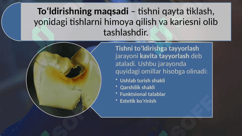 Blek bo‘yicha III- IV sinfli karies kovaklarini restavratsiya qilishning klinik tamoyillari. 3