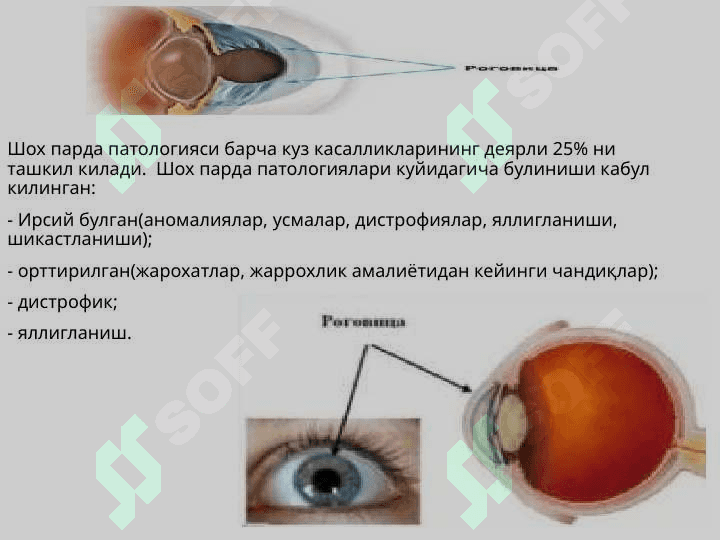 Shox parda anatomiyasi va patologiyasi 8