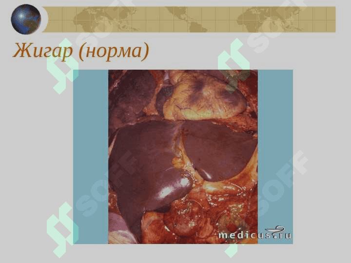 СУРУНКАЛИ ГЕПАТИТ 3