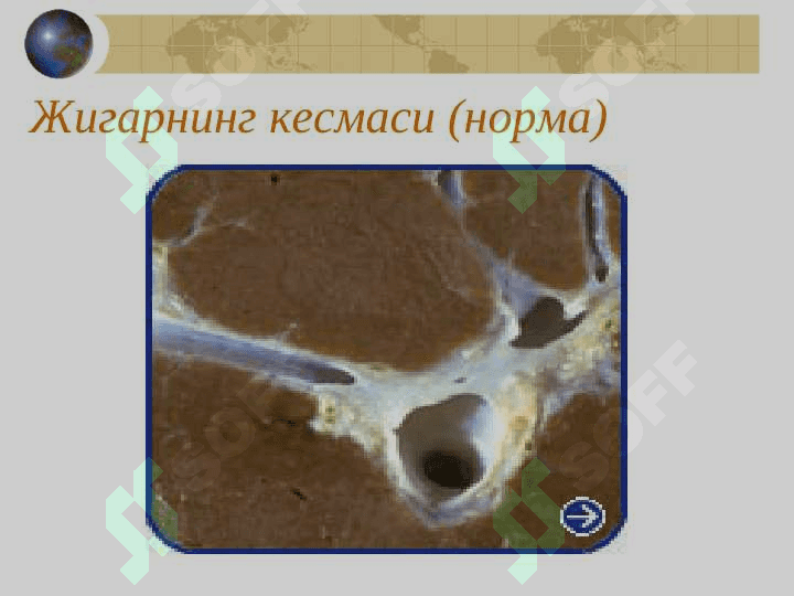 СУРУНКАЛИ ГЕПАТИТ 4