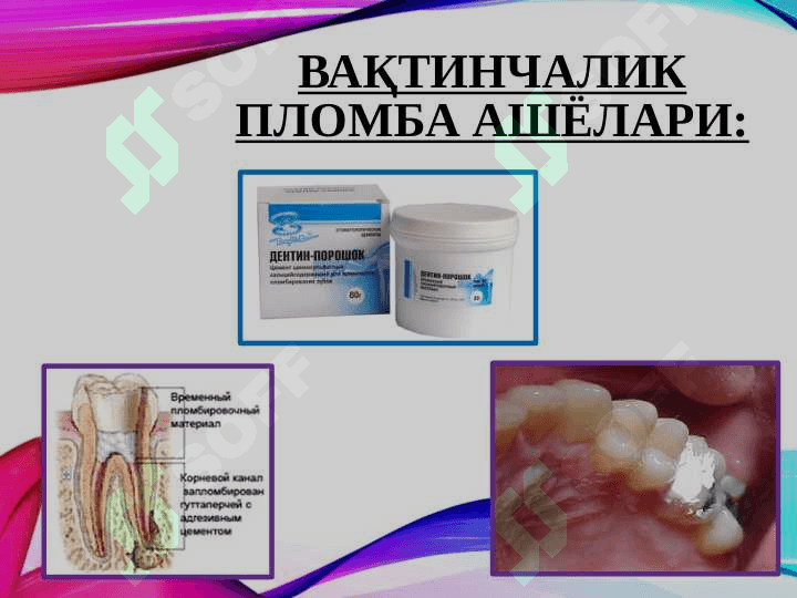 Пломба ашёларининг таснифи. Таркиби, хусусиятлари, кўллашга кўрсатмалар. 5