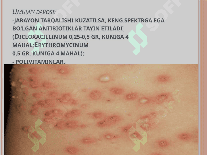 streptokokkli piodermiyalar 7