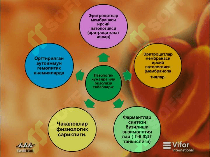 Гемолитик  анемия 7