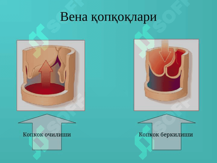 Оёқ веналарининг варикоз касаллиги 4