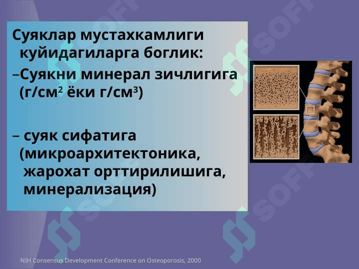Остеопороз 4