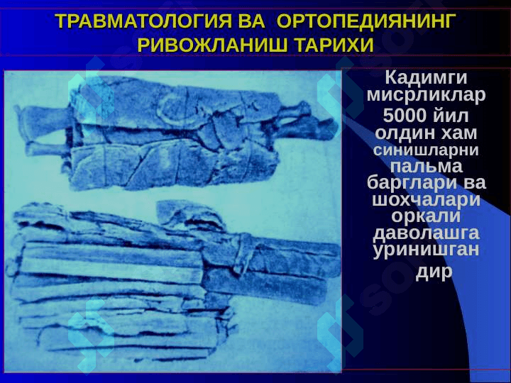 ТРАВМАТОЛОГИЯ-ОРТОПЕДИЯ, ХАРБИЙ ДАЛА ЖАРРОХЛИГИ ВА НЕЙРОХИРУРГИЯ КАФЕДРАСИ 4