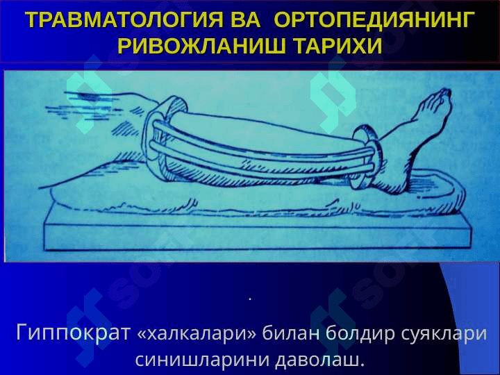ТРАВМАТОЛОГИЯ-ОРТОПЕДИЯ, ХАРБИЙ ДАЛА ЖАРРОХЛИГИ ВА НЕЙРОХИРУРГИЯ КАФЕДРАСИ 7