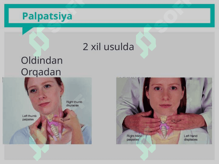 QALQONSIMON BEZ KASALLIKLARI DIAGNOSTIKASI. KLASSIFIKATSIYA. QALQONSIMON  BEZ PALPATSIYASI. SINTIGRAFIK TEKSHIRUV USULI. QALQONSIMON BEZNI ASPIRATSION BIOPSIYASI. 7