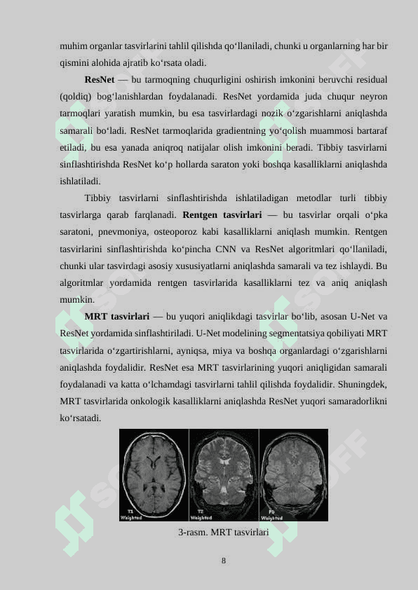 Chuqur o‘rganish algoritmlari asosida tibbiiy tasvirlarni sinflashtirish 8