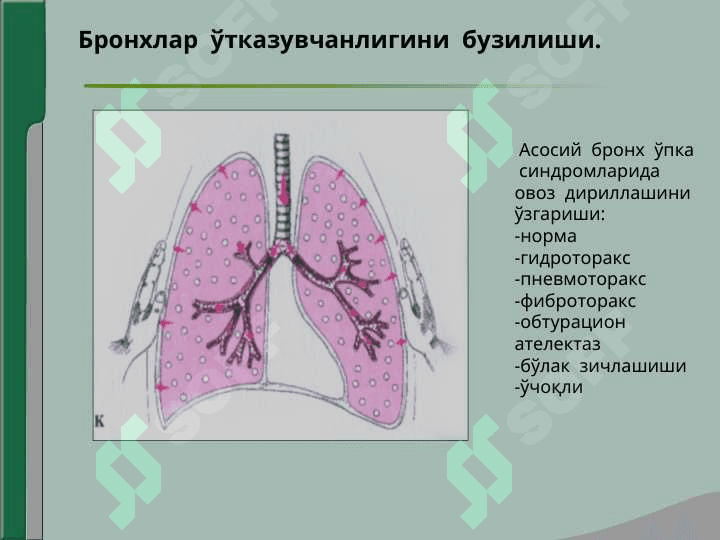 NAFAS ORGANLARI KASALLIKLARIDA ASOSIY KLINIK SINDROMLAR. BRONXLAR O`TKAZUVCHANLIGINING BUZILISHI, O`PKA TO`QIMASINI HAVO BILAN TO`LISHINI OSHIB KETISHI, O`PKA TO`QIMASINING ZICHLASHISHI, PLEVRA BO`SHLIG`IDA HAVO VA SUYUQLIKNING TO`PLANISHI, O`PKA TO`QIMASIDA KOVAK(BO`SHLIQ) HOSIL BO`LISH SINDROMI. 4