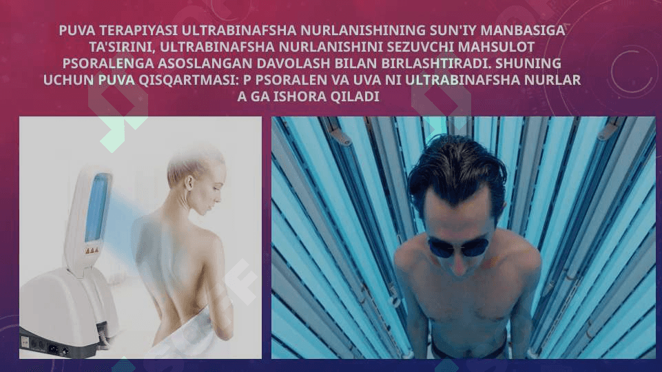 PUVA,Ozonaterapiya,elektrofarez.kriodestruksiya 2