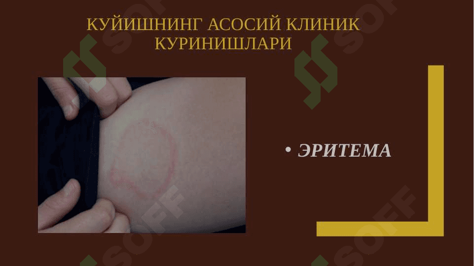 KUYISH KLINIKASI,DIAGNOSTIKASI VA SHOSHILINCH YORDAM - КУЙИШ КЛИНИКАСИ,ДИАГНОСТИКАСИ ВА ШОШИЛИНЧ ЁРДАМ 8