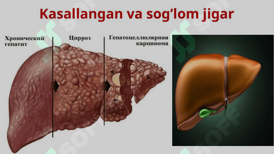 Qon infeksiyalari 6