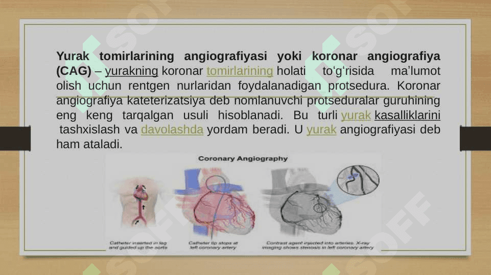 Koronar angiografiya 2