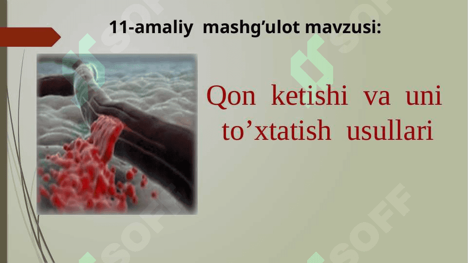 Qon  ketishi  va  uni  to’xtatish  usullari 2