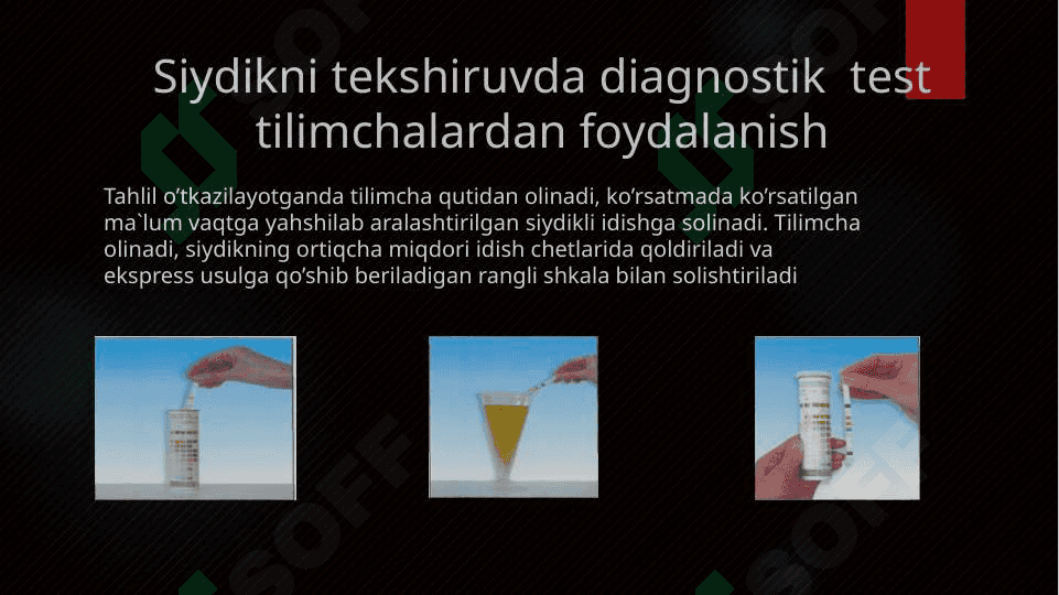 Buyrak  kasalliklarni laborator diagnostikasi. 7