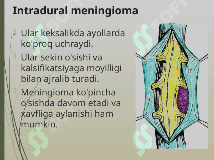 Orqa miya o’smalari 8