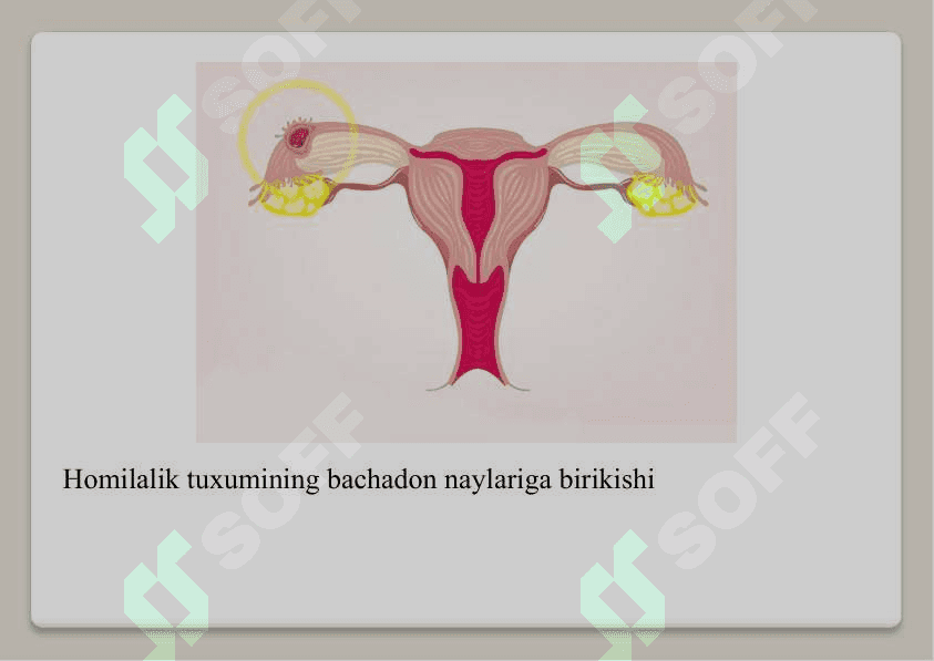 Bachadondan tashqari homiladorlik 4