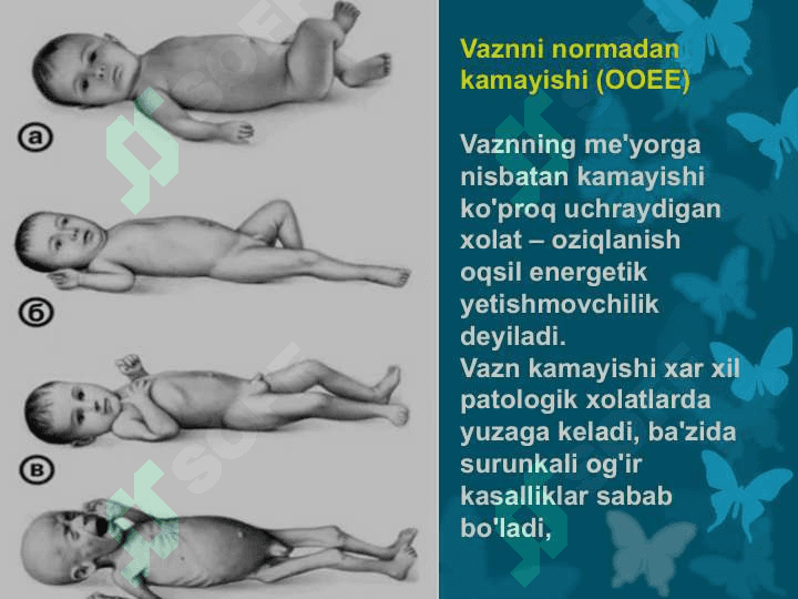 Bolalar o'sish va rivojlanishi buzilishlari semiotikasi 7