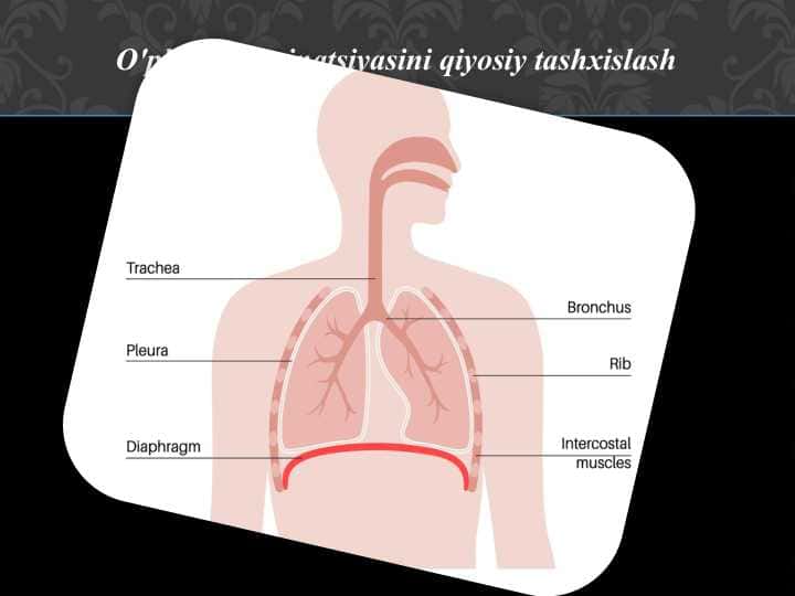 O'pka disseminatsiyasini qiyosiy tashxislash