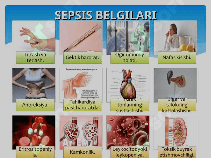 Chilla davri infekstiyalari. Akusherlik peritoniti. 6