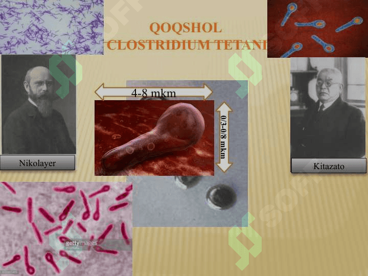 Qoqshol, gazli gangrena qoʼzgʼatuvchilari tavsifi va laboratoriya tashxisi 4