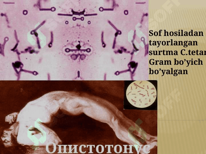 Qoqshol, gazli gangrena qoʼzgʼatuvchilari tavsifi va laboratoriya tashxisi 7
