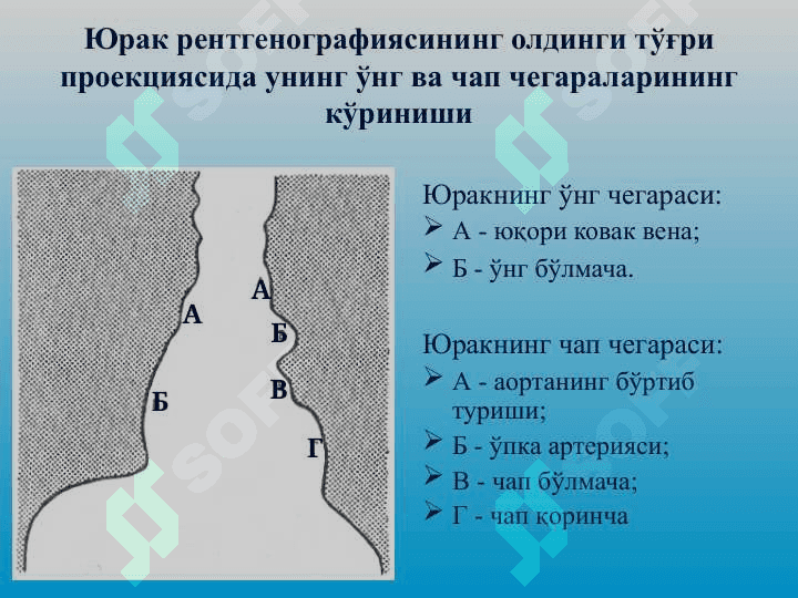 Юрак соҳасидаги шовқинлар ва уларнинг қиёсий ташҳиси 7