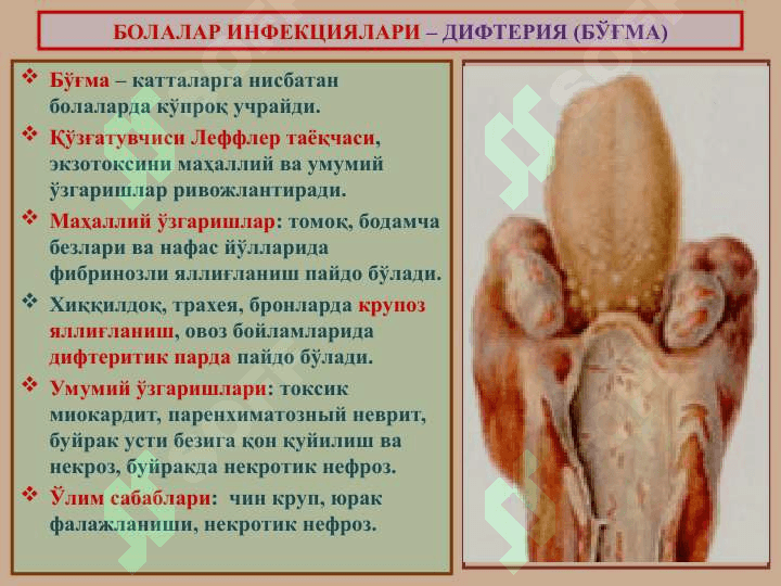 ИНФЕКЦИОН  КАСАЛЛИКЛАР 6