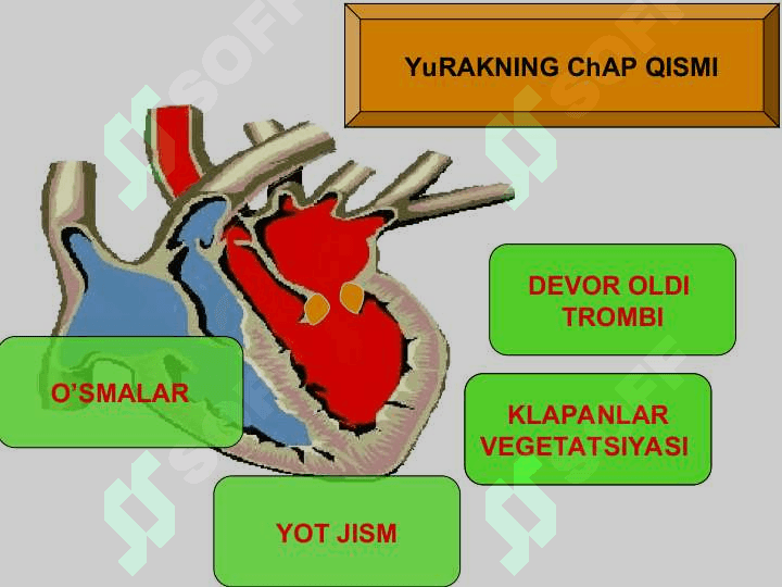 O‘tkir arterial tromboz va emboliyalar 5