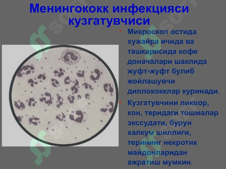 МЕНИНГОКОКК ИНФЕКЦИЯСИ 5