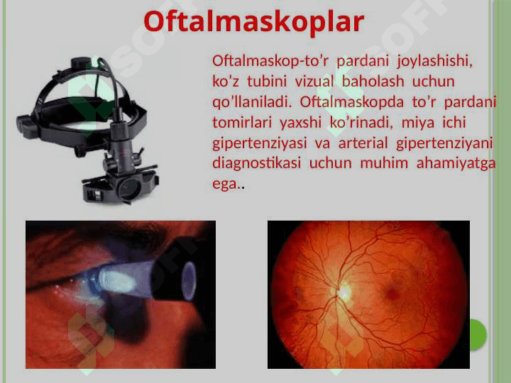 Ko’rish a’zosini tekshirish 2