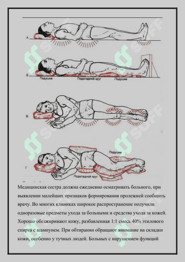 Основы ухода за хирургическими больными.  Тяжелобольные переодеваются, в белое.  Профилактика пролежней. 4