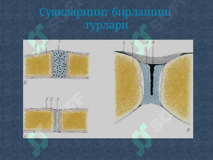 «SYNDESМOLOGIYA -СУЯКЛАРНИНГ ЎЗАРО БИРИКИШИ». 4