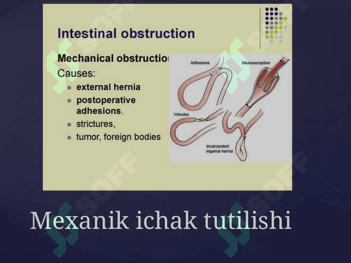 Bolalarda ichak tutilishi 6
