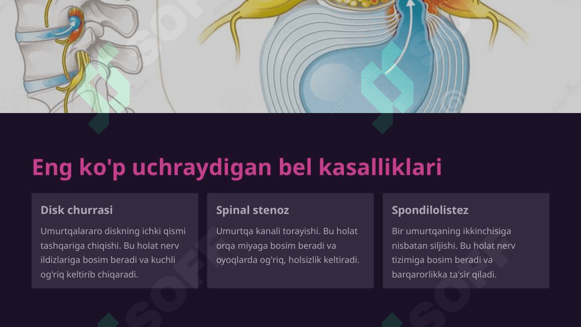 Bel sohasida amalga oshiriladigan jarrohlik amaliyotlari va ularning xususiyatlari 4