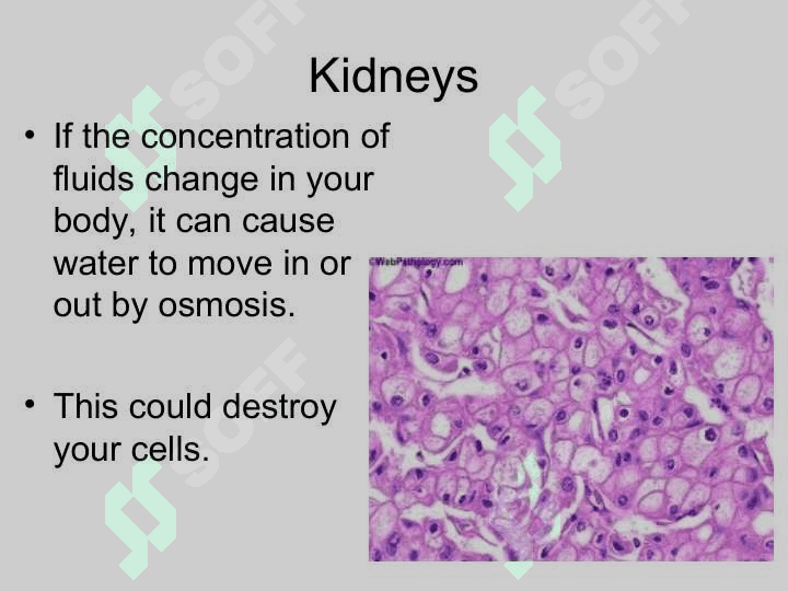Kidney 7