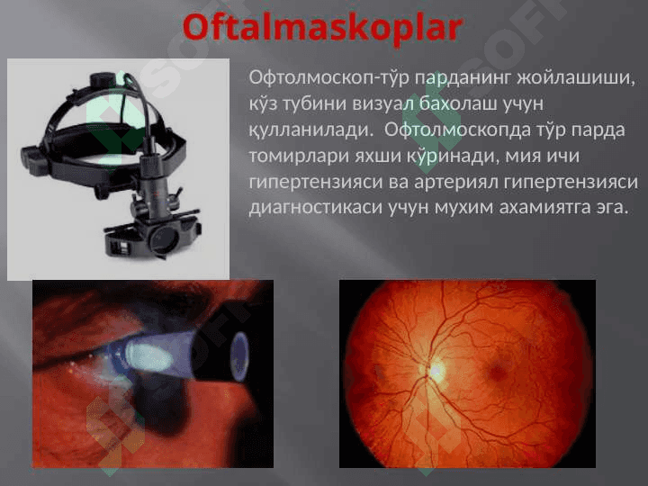 Офтолмологияда замоновий текшириш усуллари. Oftalmologiyada zamonaviy tekshirish usullari 4
