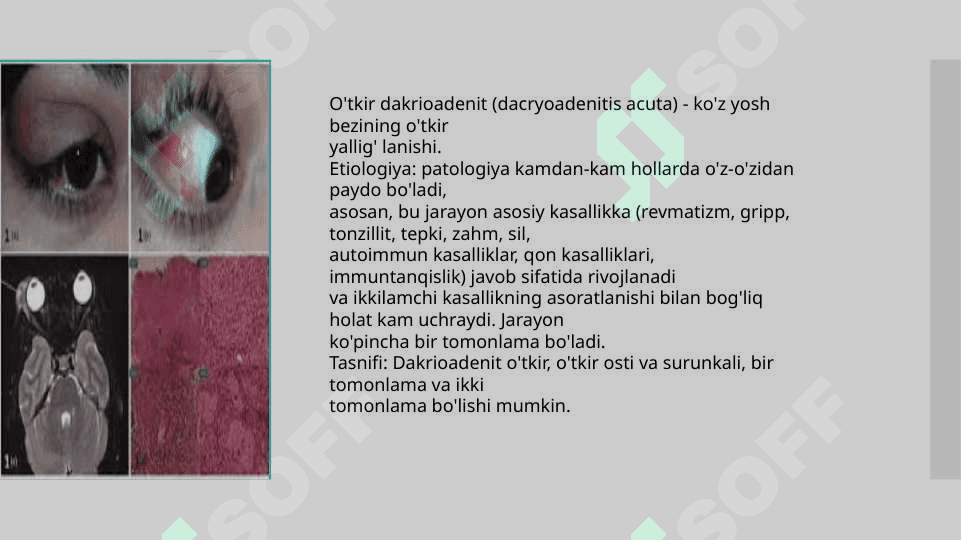 Dakriodent ko”z yosh apparati 2