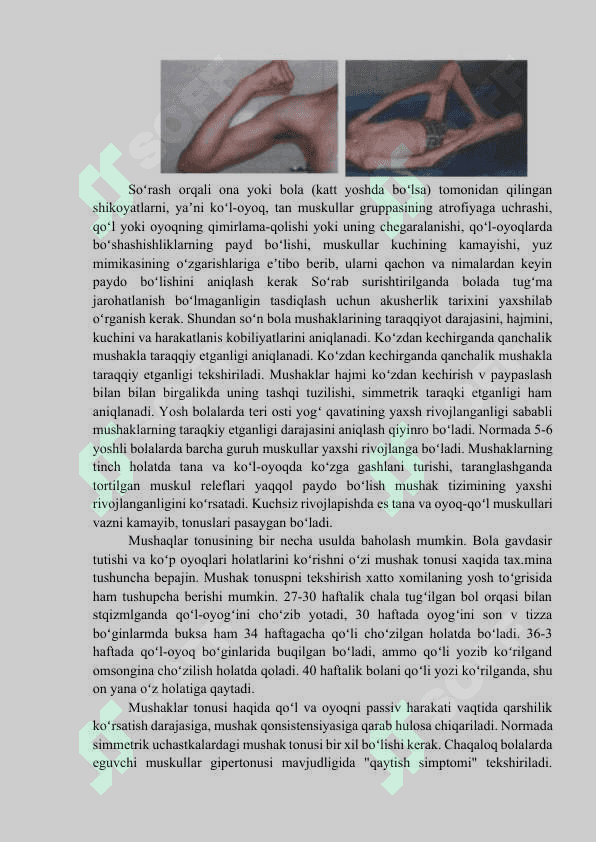 Suyak - mushak tizimining asosiy kasalliklari semiotikasi 4