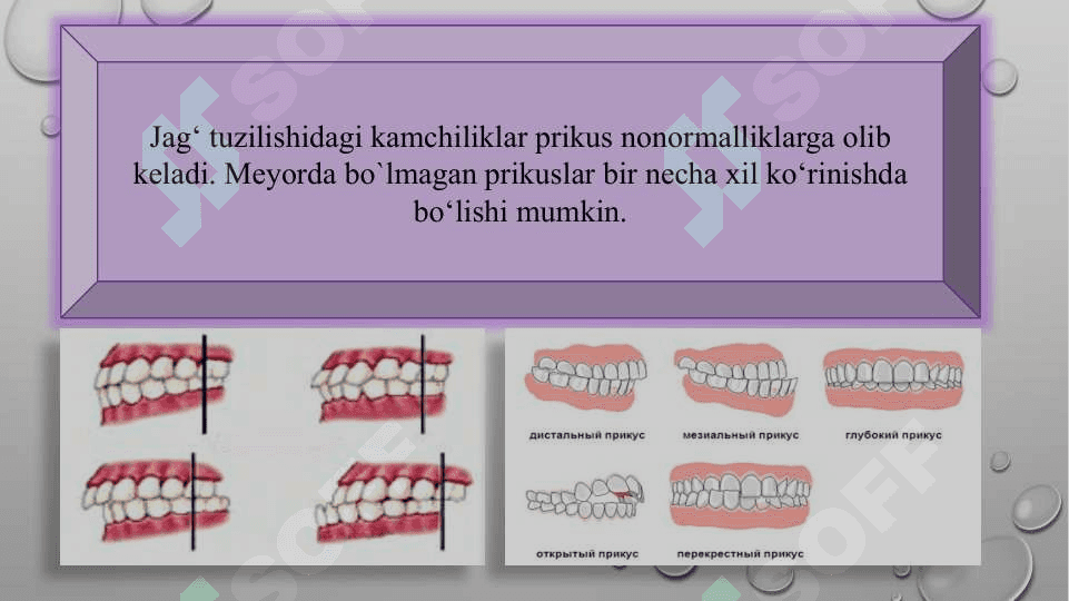 Dislaliya sabablari va shakllari, dislaliya turlari va uning namoyon bo‘lishi 6