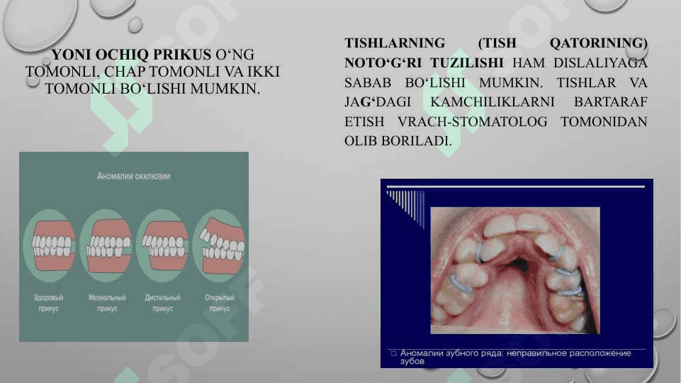 Dislaliya sabablari va shakllari, dislaliya turlari va uning namoyon bo‘lishi 8