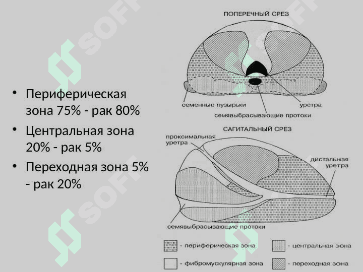 Рак предстательной железы 8