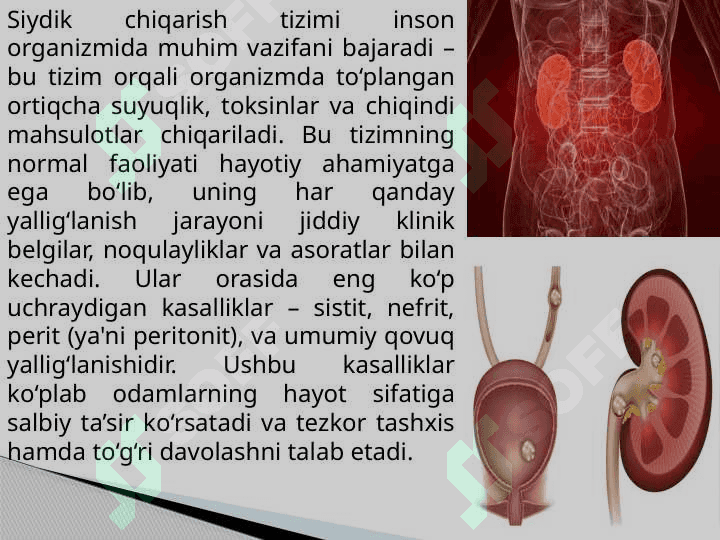 Sistit, Nefrit, Perit, qovuqni yalligʻlanishi T.pptx 3
