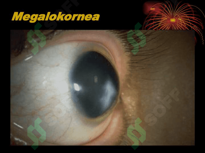 KERATITLAR 5